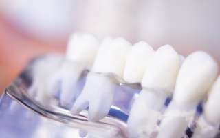 Zahnarzt Praxis Garbsen - Zahnersatz